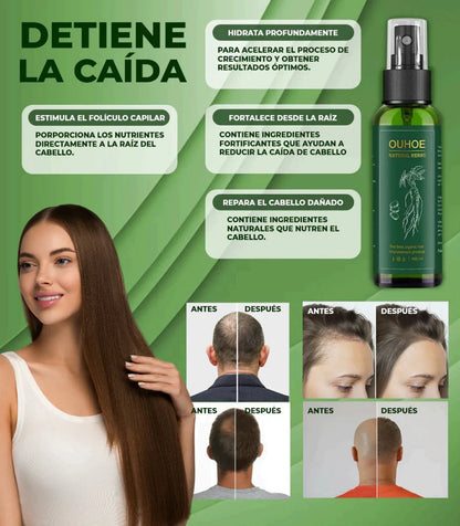 Spray Capilar OUHOE – Crecimiento Acelerado y Anticaída